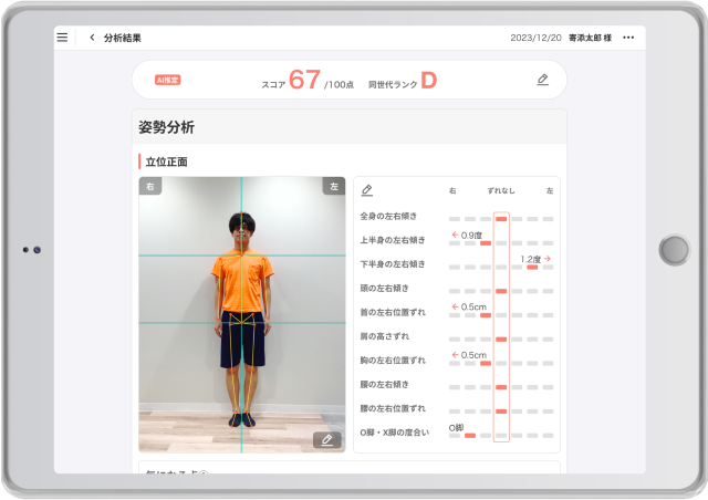 カルティ様シセイカルテHPより引用した立位正面の姿勢分析画面